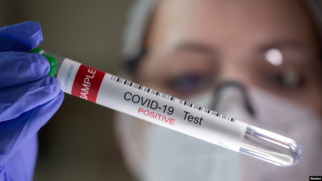 ARCHIVO -En esta ilustración se ve un tubo de ensayo con la etiqueta "COVID-19 Test positivo".