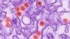 This 2016 digitally-colorized electron microscope image made available by the Centers for Disease Control and Prevention shows the Zika virus, in red, about 40 nanometers in diameter.