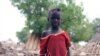This woman, hands disfigured by leprosy and with no means of support, begs for food or any other offerings that can help her survive at a leper colony outside Juba, South Sudan’s capital. 