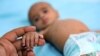 FILE - A woman holds the hand of a Yemeni child suffering from malnutrition as he lies in a bed at a treatment center in the country's third-city of Taez, Oct. 28, 2020.