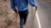 FILE - Muscular dystrophy causes muscles to weaken and wither. New research shows a potential cure for Duchenne muscular dystrophy, which affects one to 5,000 boys worldwide.