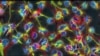Researchers Seek Ways to Help Damaged Brains Heal