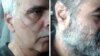 اعتصاب غذای زندانیان سیاسی رجایی شهر در پی حمله زندانیانی "با سابقه شرارت"