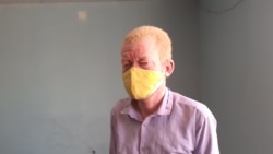 Albinos queixam-se de discriminação 2:06