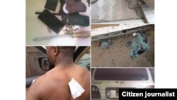 Fotos da tentativa de assassinato