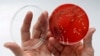 People enter the Russell Investments Center building Monday, Dec. 7, 2015, in Seattle. Over 100 people have gotten sick in a norovirus outbreak at the office building, health officials reported Monday.