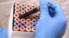 Blood Test Could Diagnose Depression