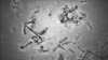 Debris from a shipwreck — including an anchor — lays on the Indian Ocean floor, nearly 4 kilometers (2.5 miles) below the surface, off the west coast of Australia. (Photo courtesy of ATSB) 
