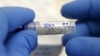 US Launches Experimental Zika Vaccine Clinical Trials