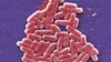 This 2006 colorized scanning electron micrograph image made available by the U.S. Centers for Disease Control and Prevention shows the O157:H7 strain of the E. coli bacteria.