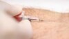 FILE - A blood test.