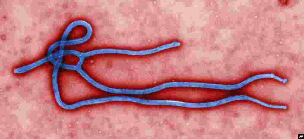Ebola virusining mikroskopdan ko'rinishi
