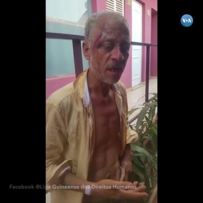Jornalista António Aly Silva raptado e espancado na Guiné-Bissau