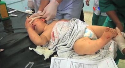 América Latina rechaza ataques en Gaza
